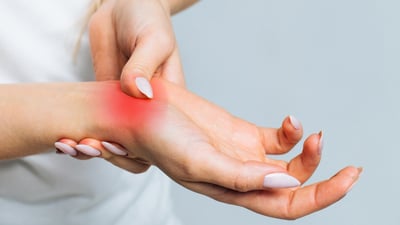 Rheumatoid Arthritis