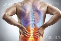 Back Pain, Sciatica