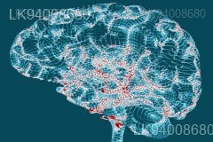 Parkinsonism Parkinsons Disease