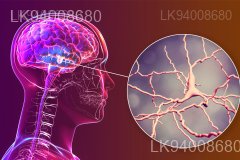 Parkinsonism Parkinsons Disease