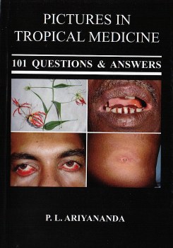 Pictures in Tropical Medicine : 101 Questions & Answers