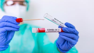 PCR Testing